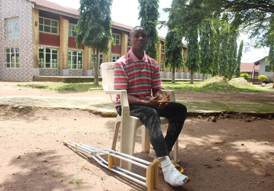 Abel Adenawo, a survivor of Black Sunday, took a bullet to his foot, penetrating his metatarsal bone. (GSR photo/Valentine Iwenwanne)