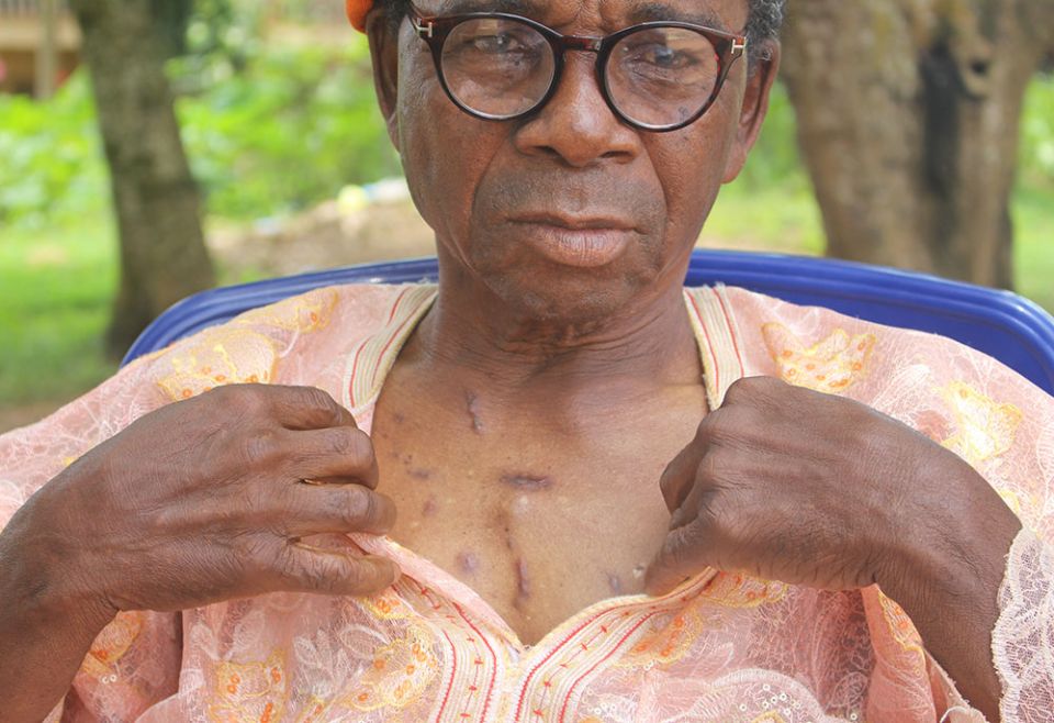 Despite a gunshot wound to his chest, Bade Salau, 74, survived the Black Sunday attack on St. Francis Xavier Catholic Church June 5 in Owo, Ondo, Nigeria. (GSR photo/Valentine Iwenwanne)